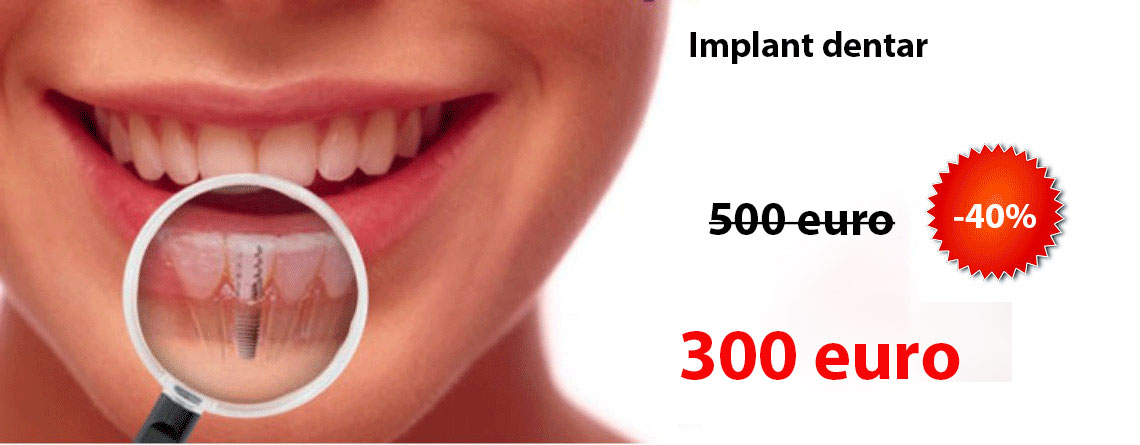 Implant dentar Alpha Bio pret 300 euro